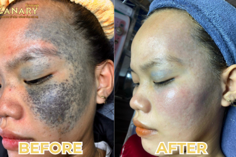 TỰ TIN VỚI LÀN DA SÁNG MỊN VÀ TRÀN ĐẦY SỨC SỐNG VỚI CANARY BEAUTY!